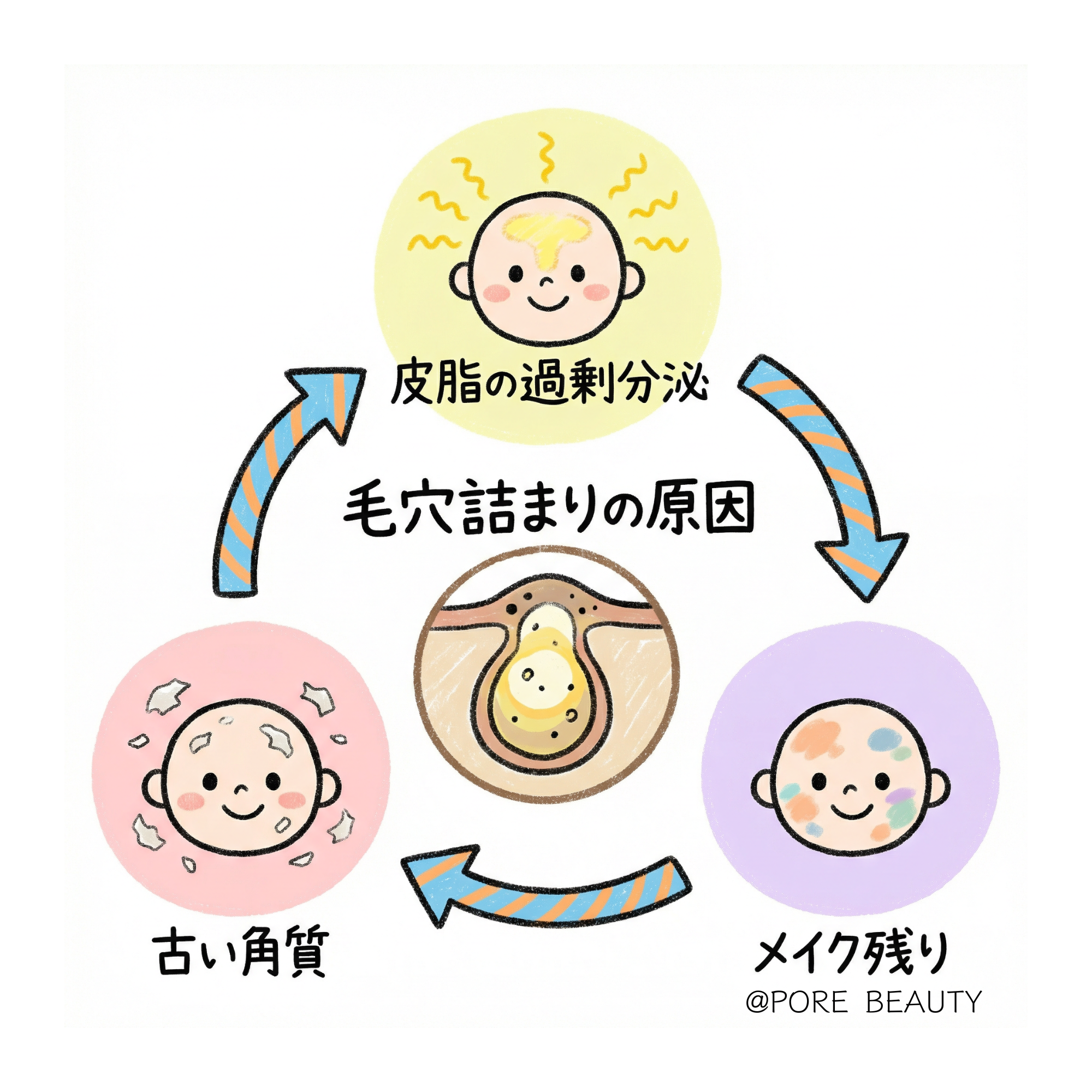 毛穴詰まりの3つの原因を示した図解イラスト